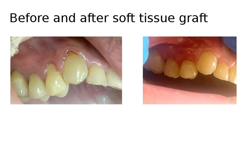 before/after