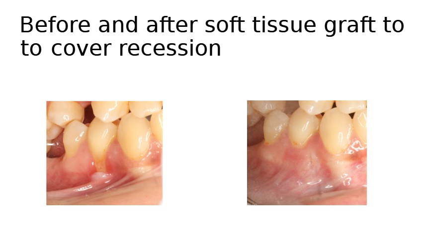 before/after